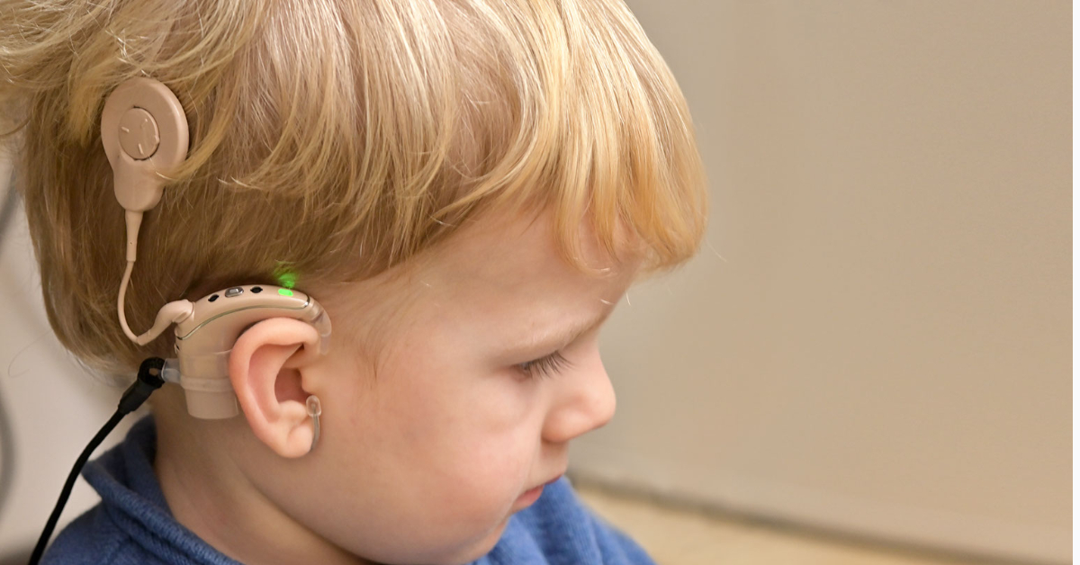 Cochlear Implant Image