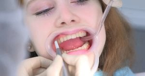 Steps to Maintaining Oral Health