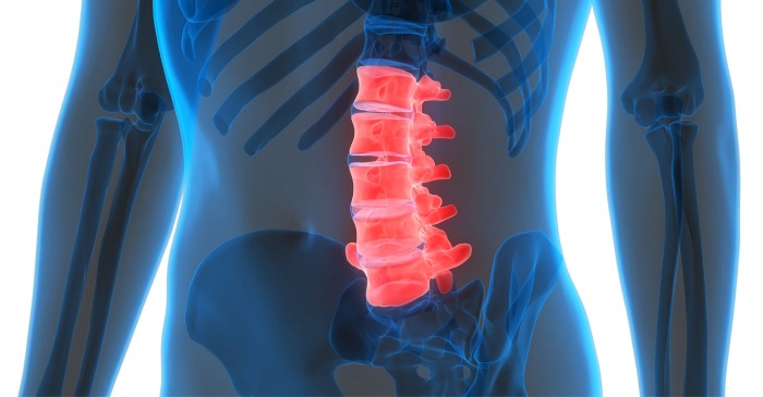 Anterior Lumbar Interbody Fusion: Introduction, Information