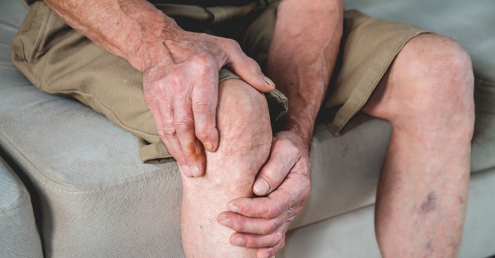 Arthritis: Causes, Types, Symptoms, Diagnosis & Treatment Options