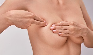 Breast Self Exam (BSE) Image