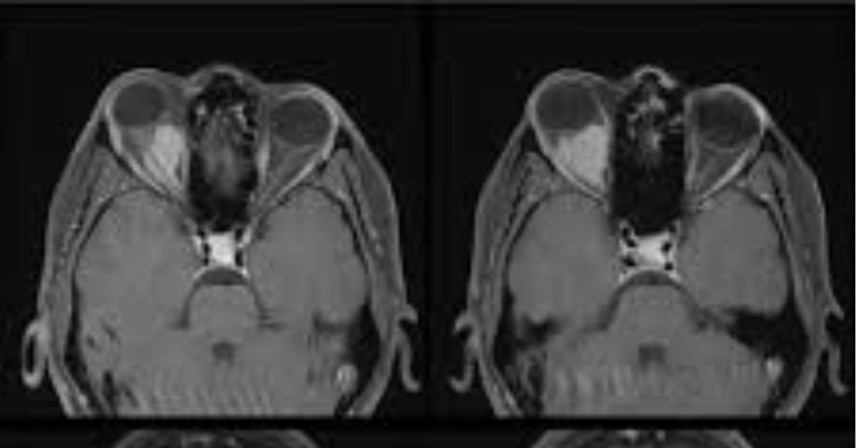 cranial-nerves-iii-iv-and-vi-clinical-gate