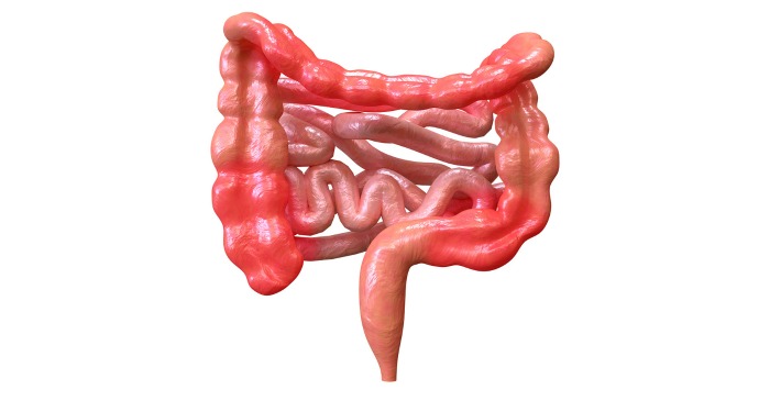 Crohn's Disease: Causes, Symptoms, Diagnosis & Treatment options