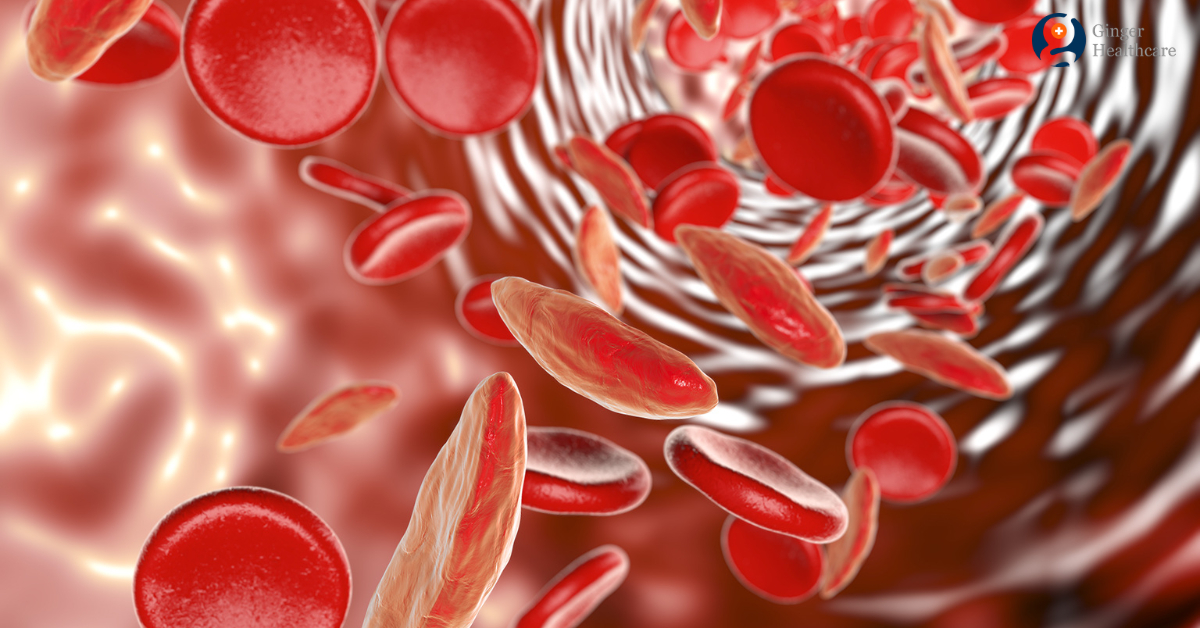 Sickle Cell Anemia Types Causes Symptoms Diagnosis Treatment