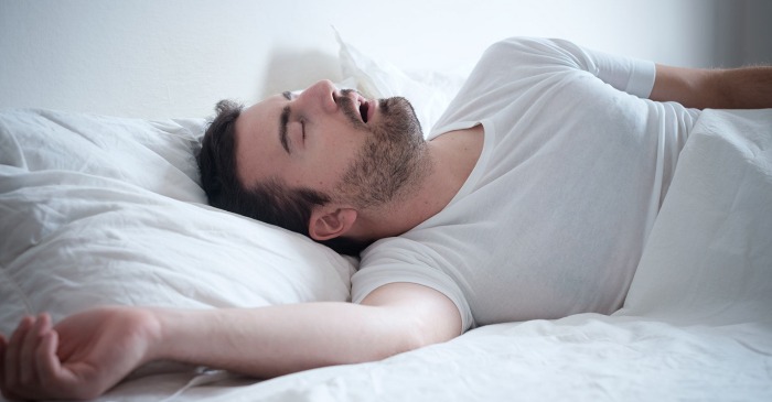 Sleep Apnea: Types, Causes, Symptoms, Diagnosis & Treatment