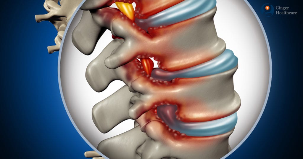 Laminectomy Indications, Types, Preparation, Procedure