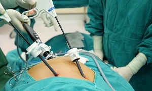 Surgery Laparoscopic Image
