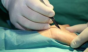 Wrist Surgery Image