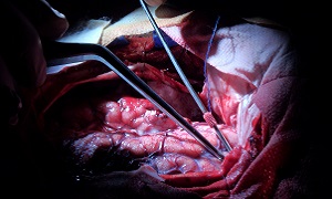 Brain Surgery Image