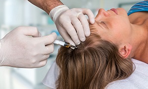Hair injection Image