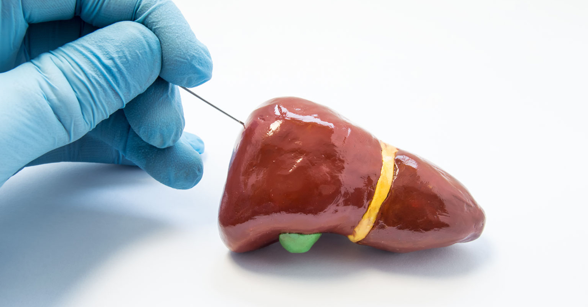 Liver Biopsy image