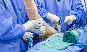 Surgery Shoulder Joint Arthroscopy Image