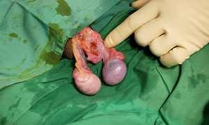 Surgery Orchidopexy Image