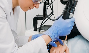 Mole Removal Cryotherapy Image