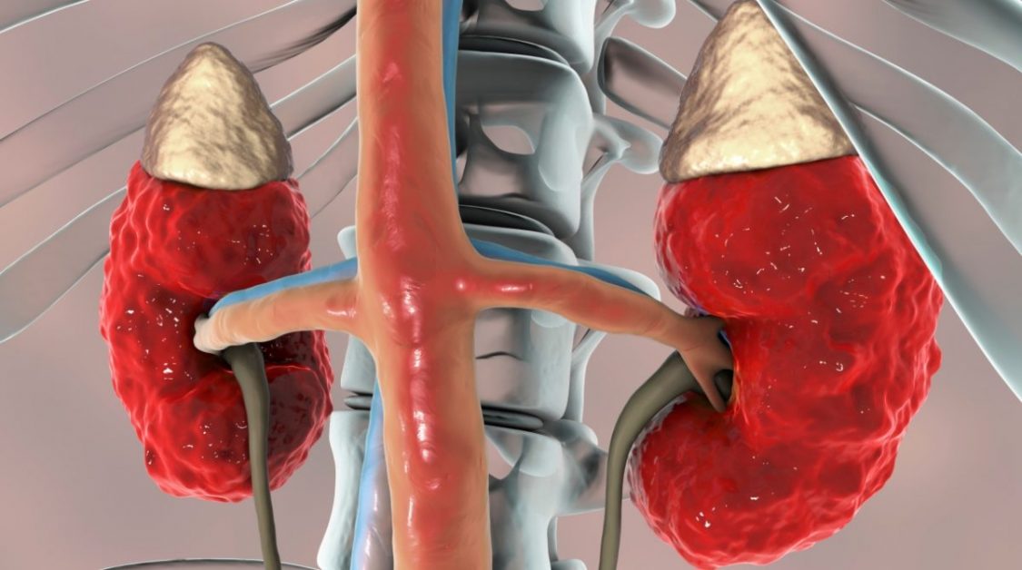 Acute Kidney image