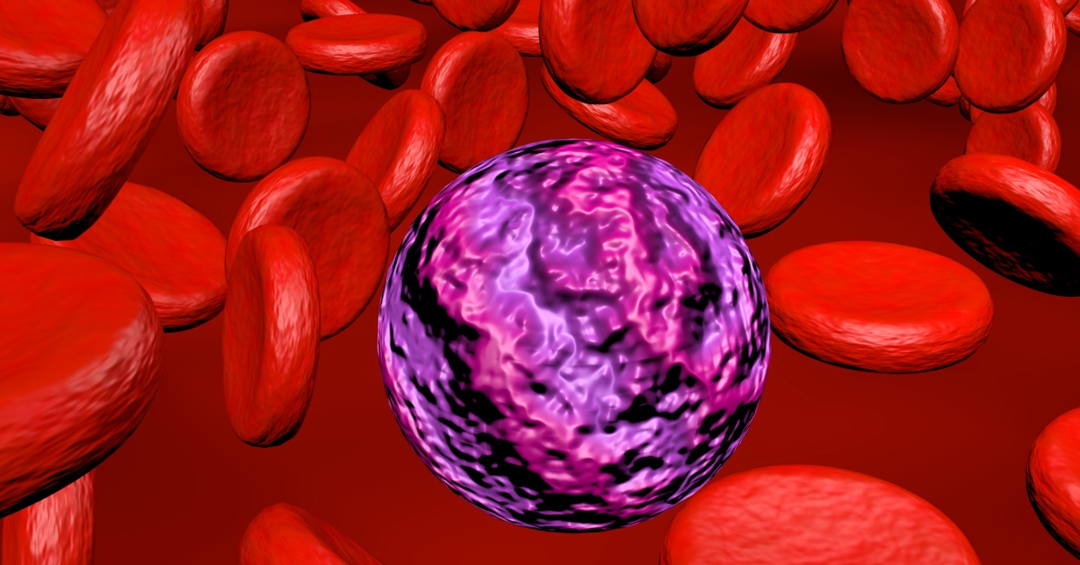 Chronic Myelomonocytic Leukemia image