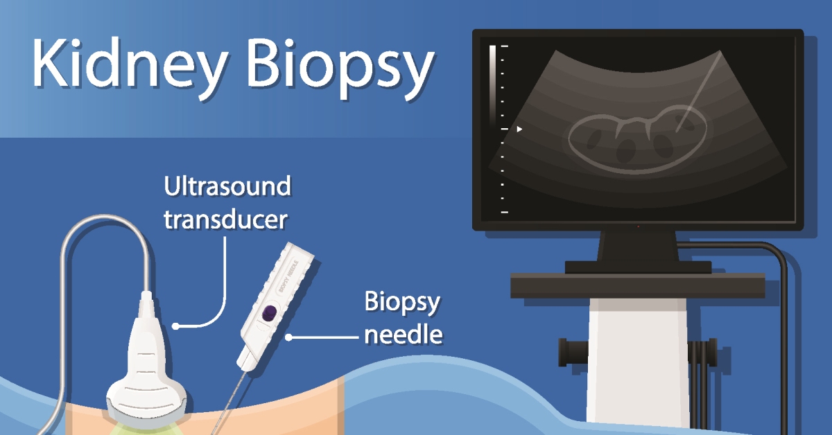 Kidney Biopsy image