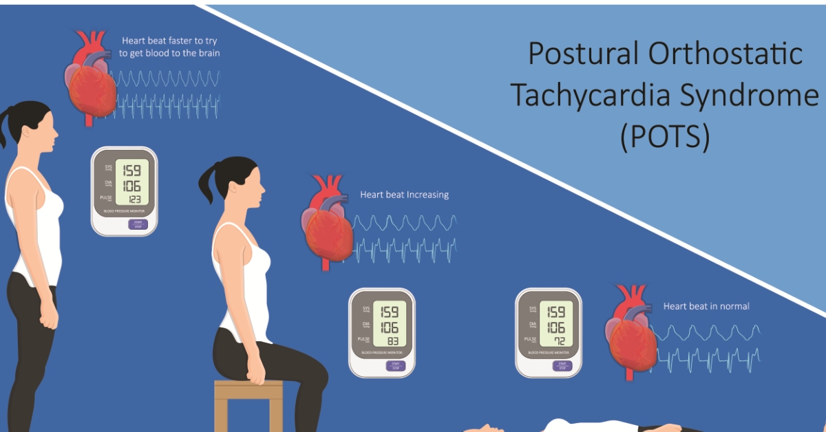 Postural Tachycardia image