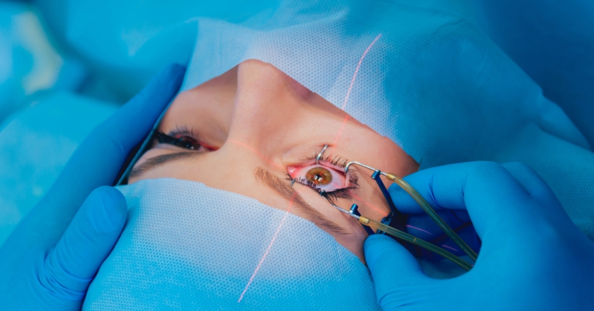 Strabismus Surgery image
