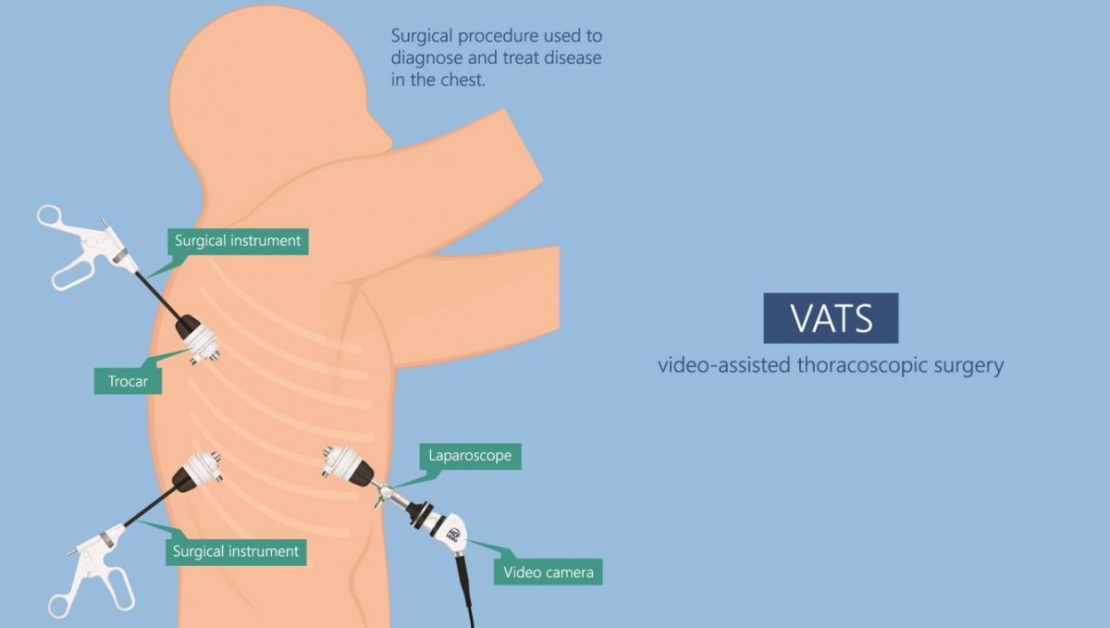 VATS image