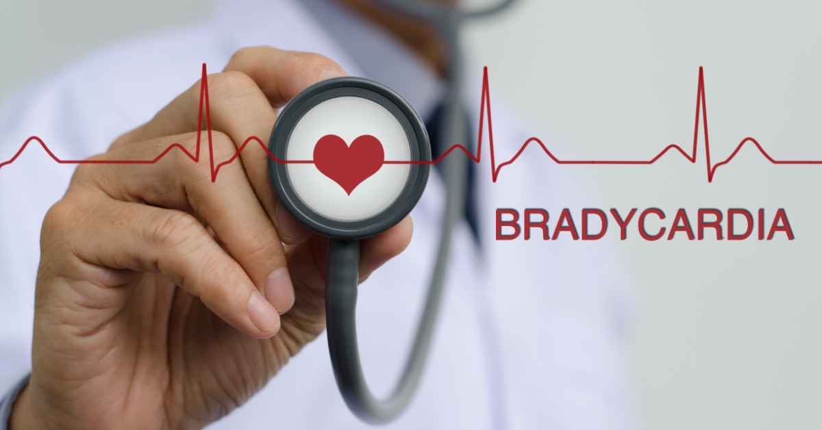 Bradycardia image