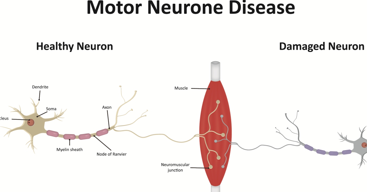 Motor Neuron image