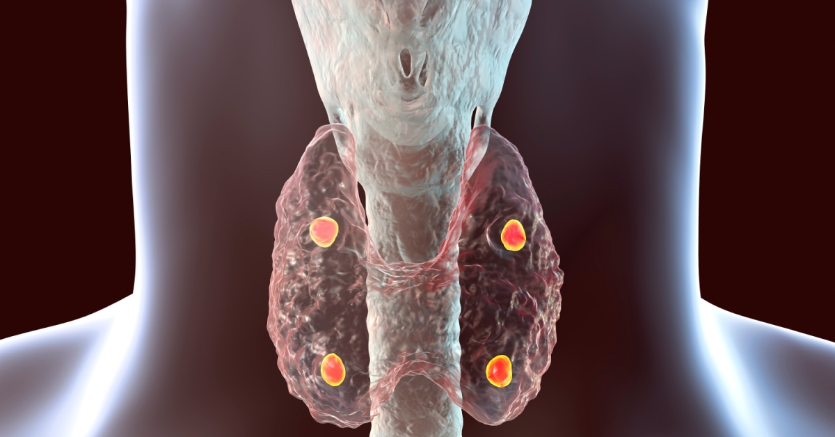 Thyroid image