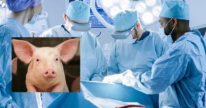 Pig-To-Human Organ Transplant