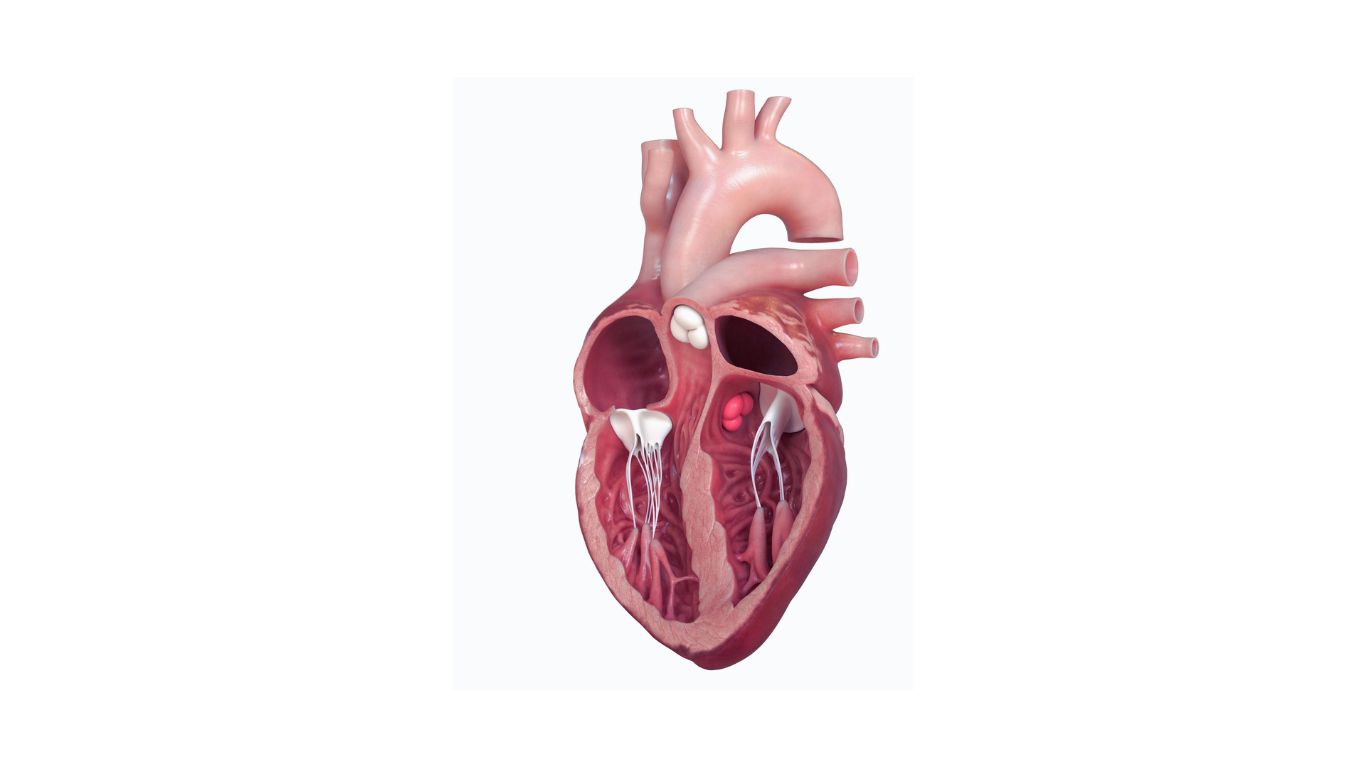 Aortic valve stenosis