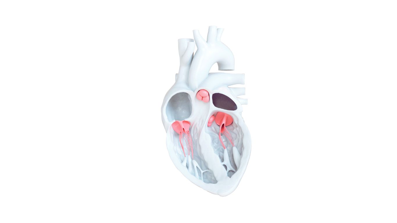 Aortic valve regurgitation