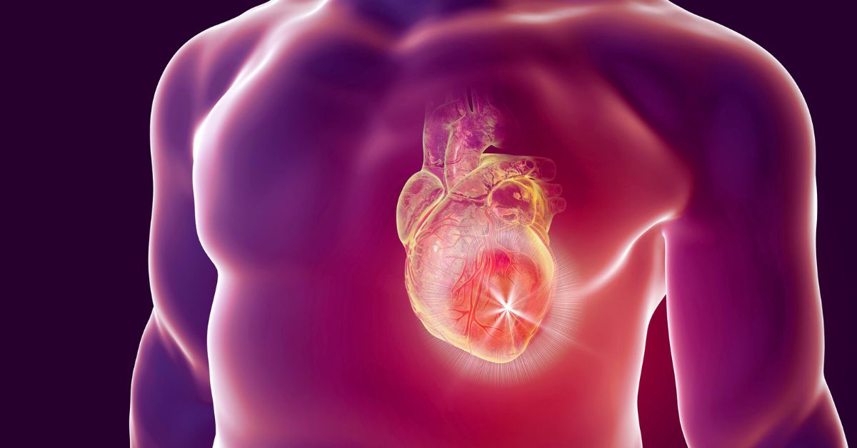 Hypoplastic Left Heart Syndrome